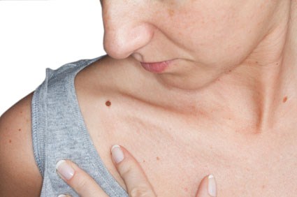 Les signes du cancer de la peau : un Belge sur trois les connaît