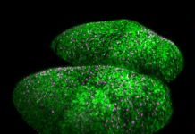 Santé : Lumière sur la coordination de l’activation des cellules souches neurales Santé : Lumière sur la coordination de l'activation des cellules souches neurales